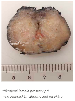 patologie - prostata.png (142 KB)