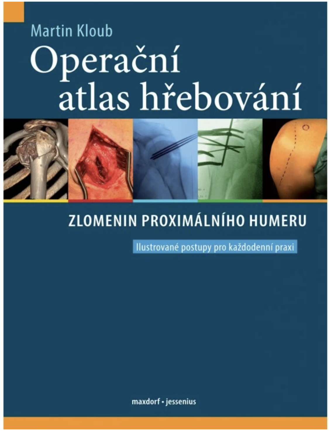 Operační atlas hřebování zlomenin proximálního humeru.png (1.38 MB)