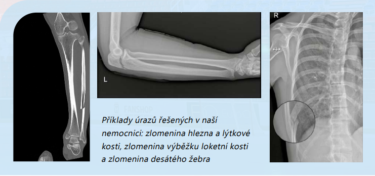 zranění ms.png (225 KB)